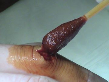 Machete Finger Cut